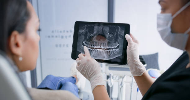 Licensed Tooth Extraction service in Winter Garden, FL - Smile Center Dentistry